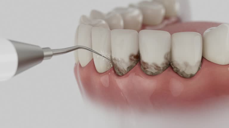 Trusted Dental Implants service in New Tazewell, TN - Dentist Open Now